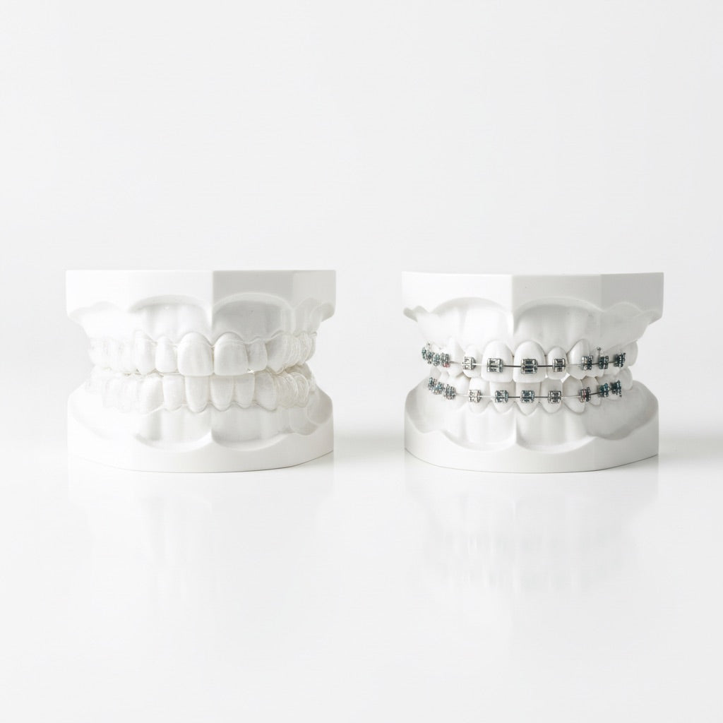 Clear aligners and braces model for orthodontic cost guide
