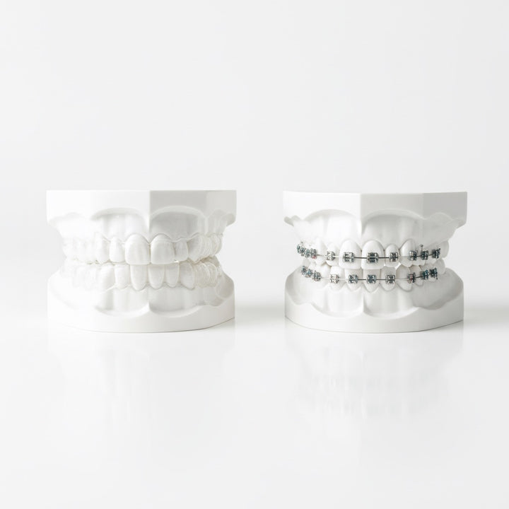 Clear aligners and braces model for orthodontic cost guide